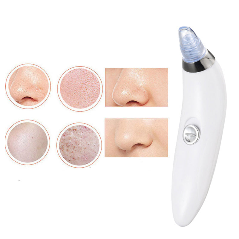 4 in 1 Derma Blackheads Remover Machine