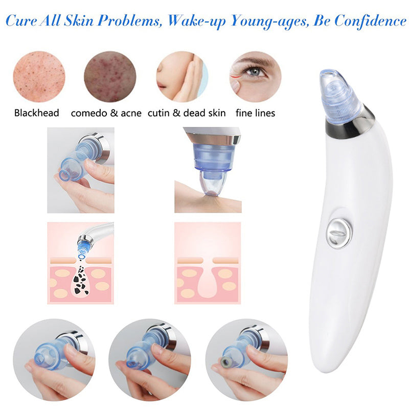 4 in 1 Derma Blackheads Remover Machine