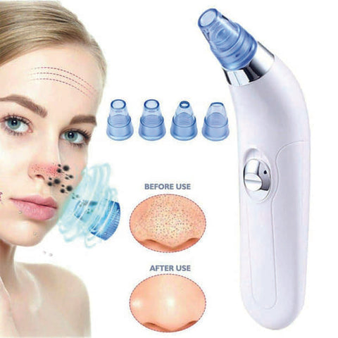 4 in 1 Derma Blackheads Remover Machine